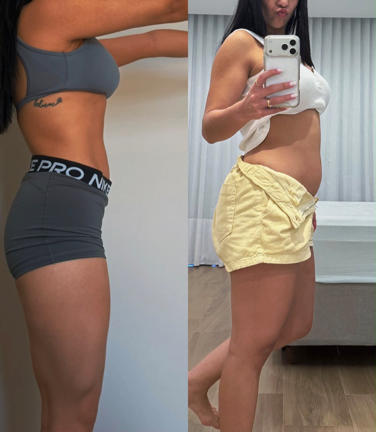 Transformação real de paciente 4 — antes e depois