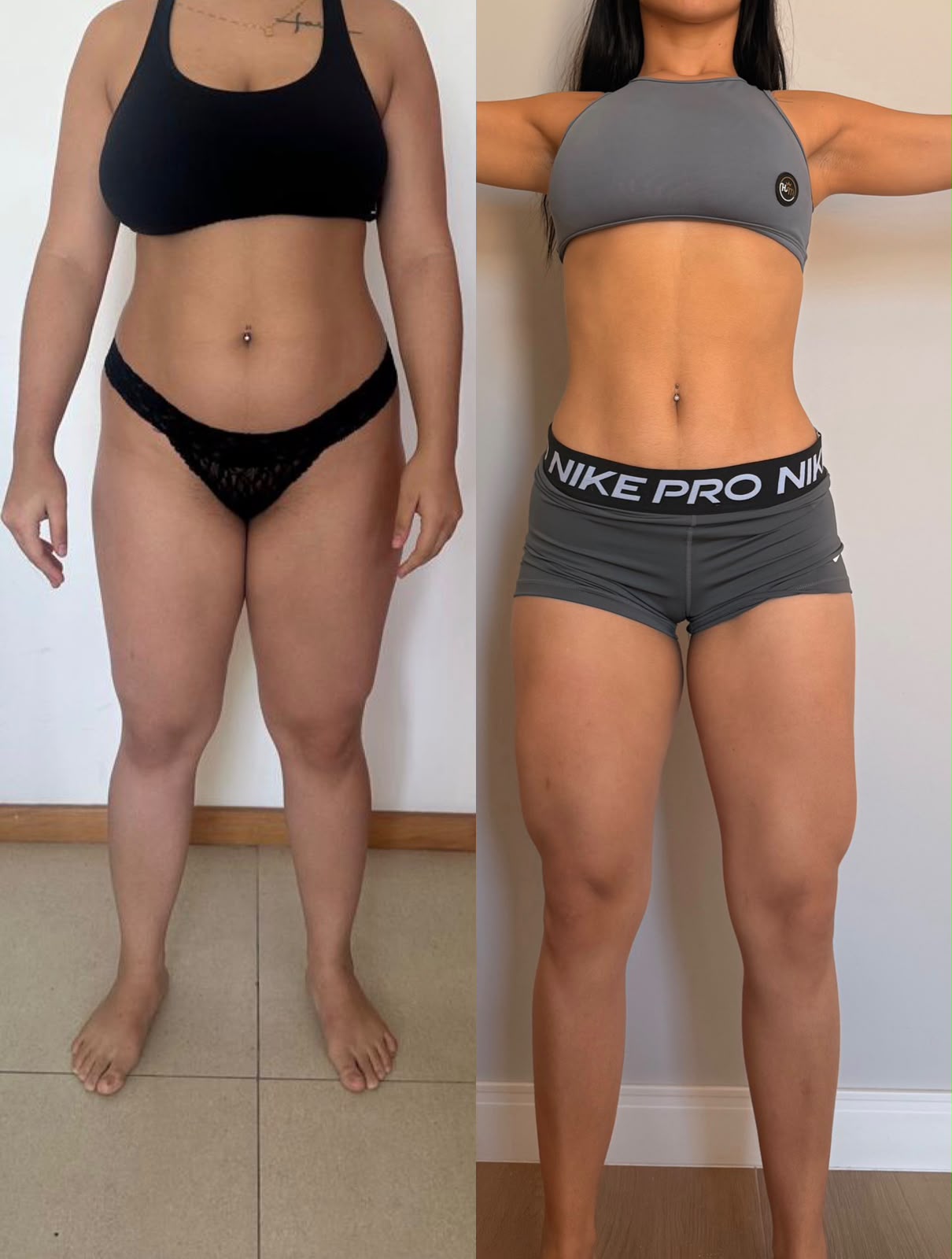 Transformação real de paciente 3 — antes e depois