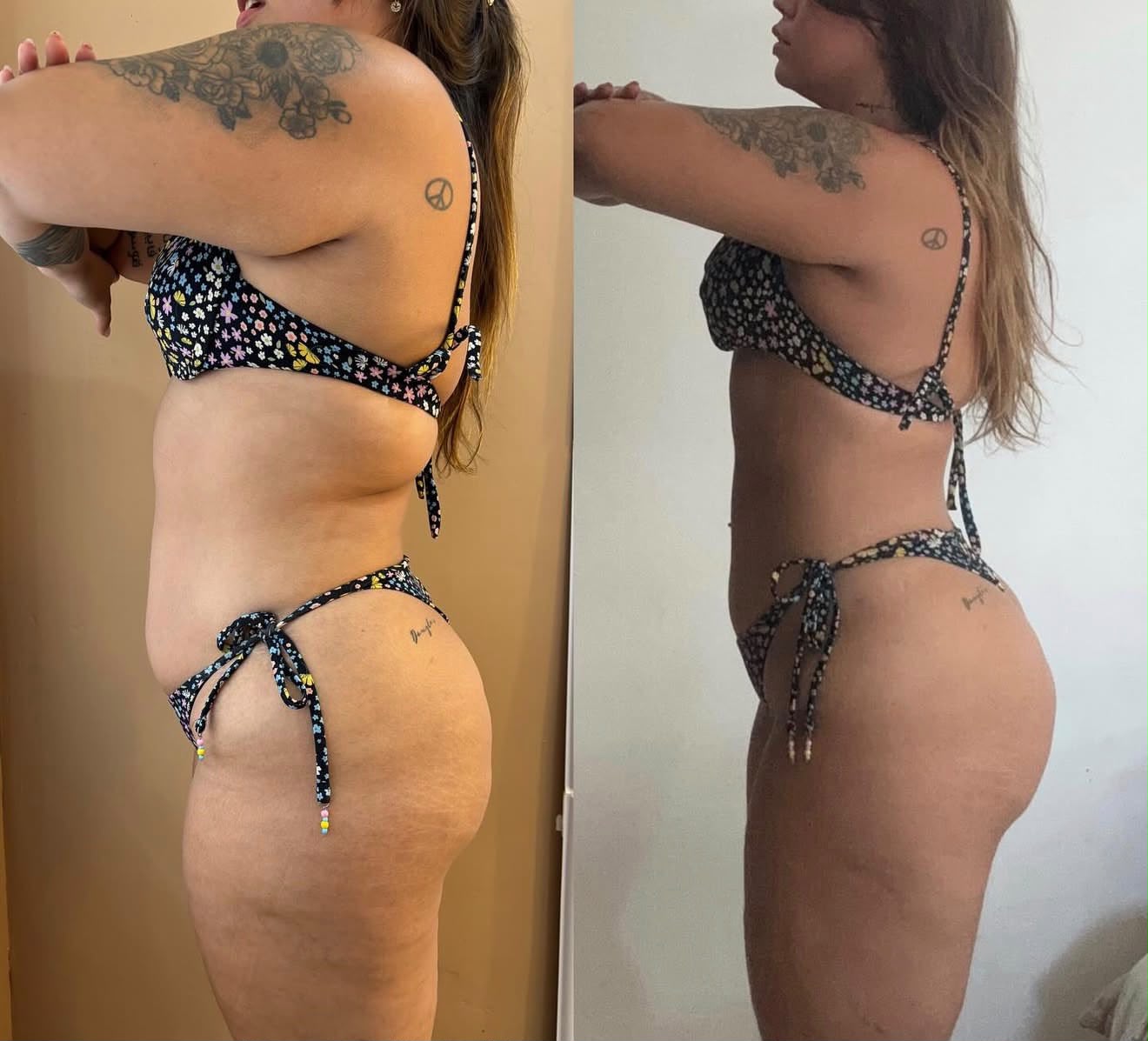 Transformação real de paciente 2 — antes e depois